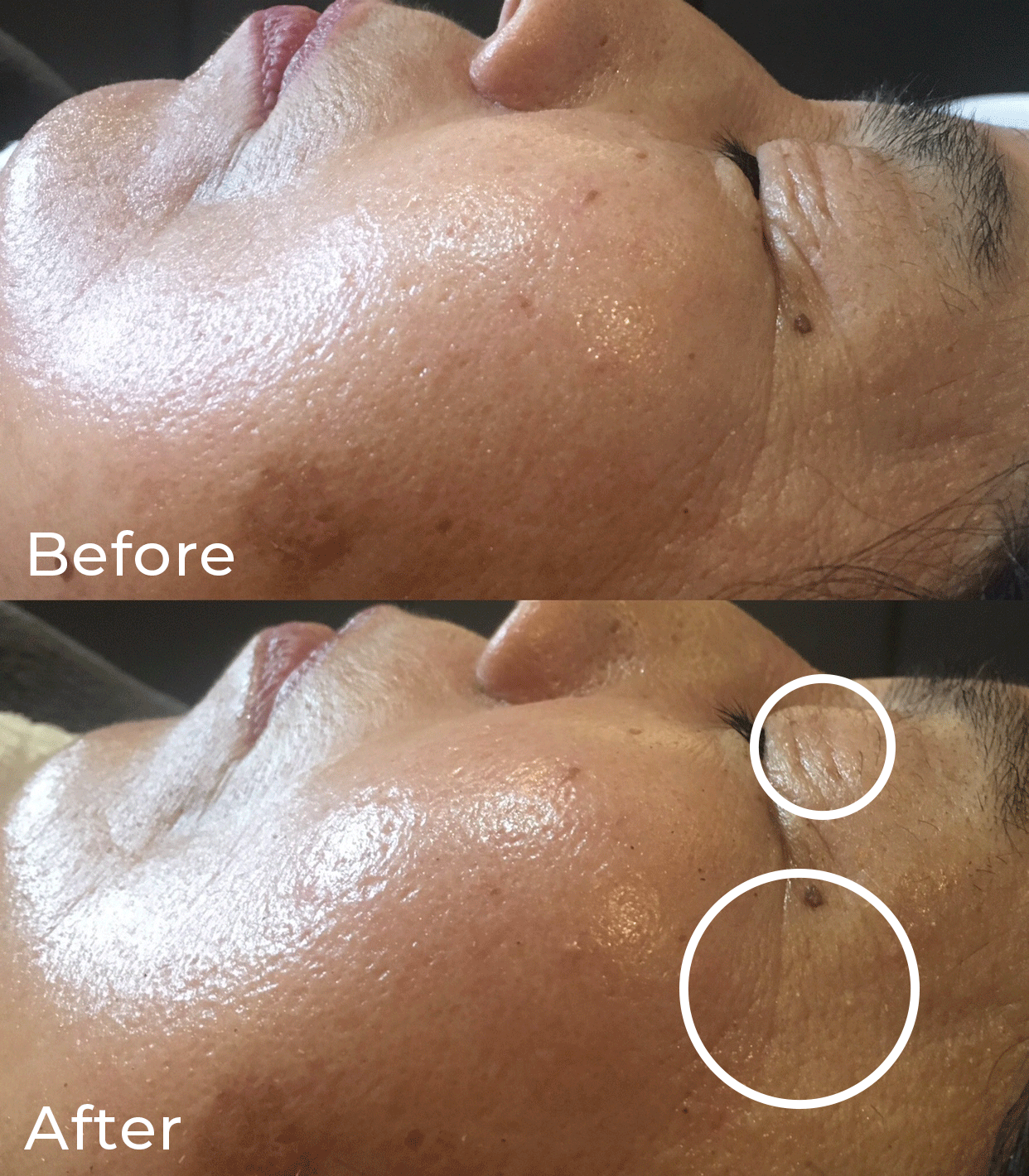 ビフォーアフター